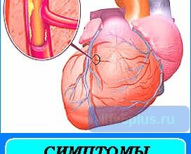 Симптомы ишемии - серьезная опасность для сердца! 3 alt="симптомы ишемии"